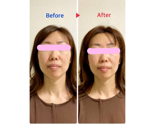 68F090D7-D583-4A11-883C-BB7CC8E1222B